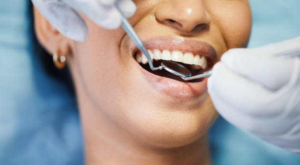 Best Emergency Treatment for Oral Infections in Estill, SC