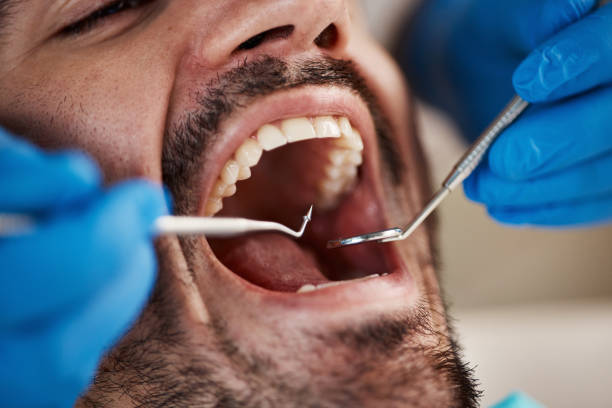 Best Emergency Dental Care for Sports Injuries in Estill, SC