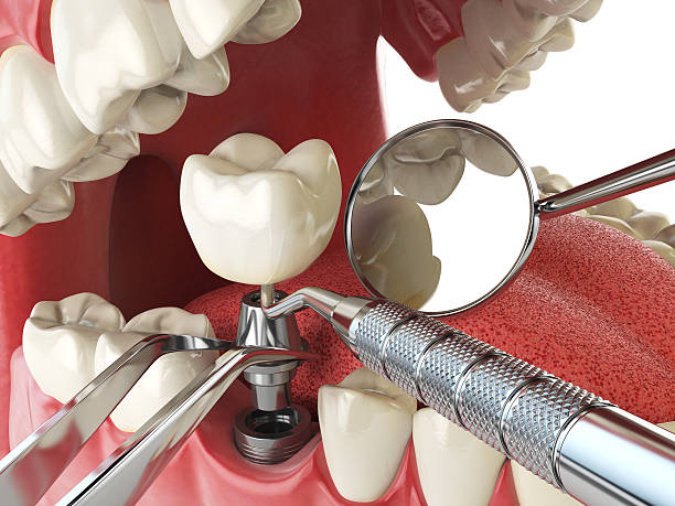 Best Dental Abscess Treatment in Estill, SC
