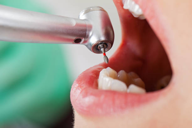 Best Emergency Denture Repair in Estill, SC